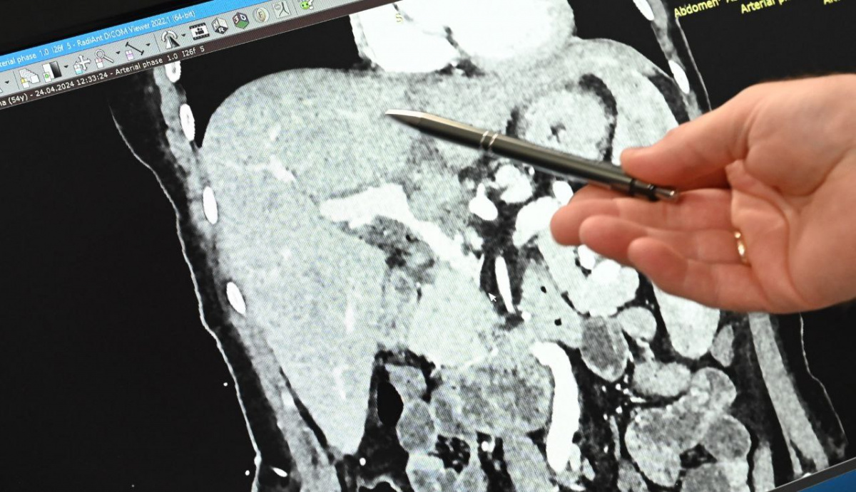 Как в Челябинской области организуют лечение от рака: путь от поликлиники до консилиума*