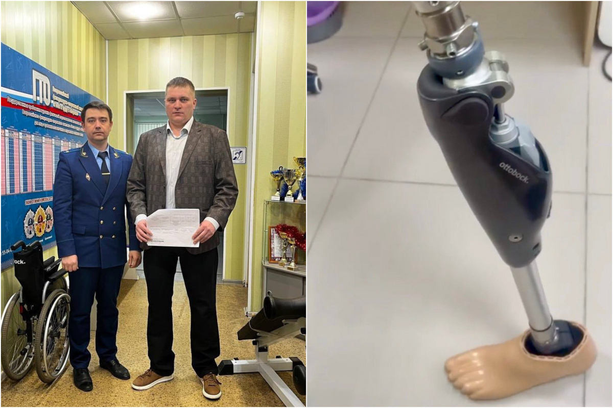 Жителю Челябинской области протез выдали только после жалобы в прокуратуру*