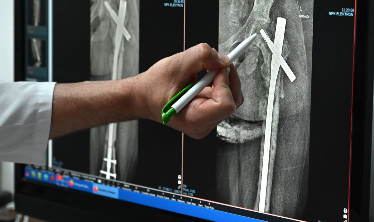 Гололёд и снегопады увеличили количество пациентов в травмцентре Челябинска*