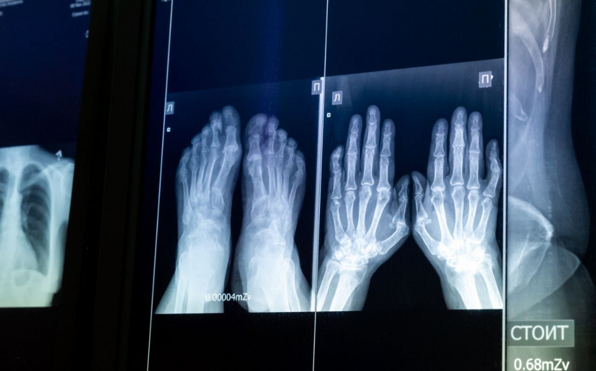 Детская больница Челябинска получила новый цифровой рентген-аппарат*