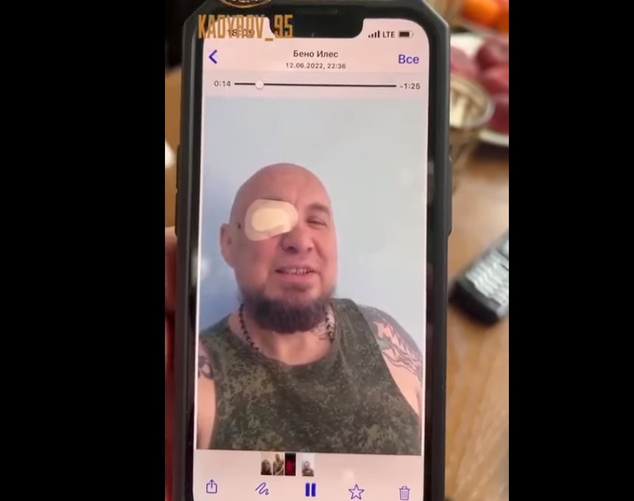 Рамзан Кадыров показал видео с челябинским солдатом, потерявшим глаз на Украине