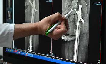 Гололёд и снегопады увеличили количество пациентов в травмцентре Челябинска