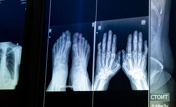 Детская больница Челябинска получила новый цифровой рентген-аппарат