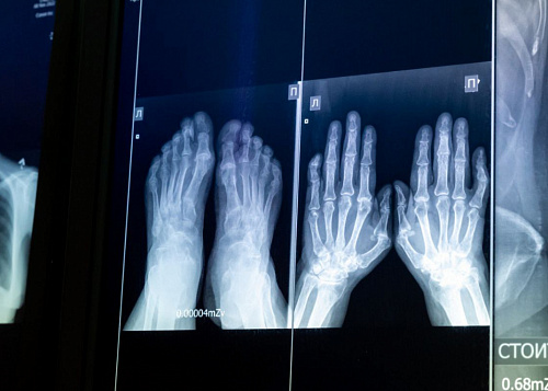 Детская больница Челябинска получила новый цифровой рентген-аппарат