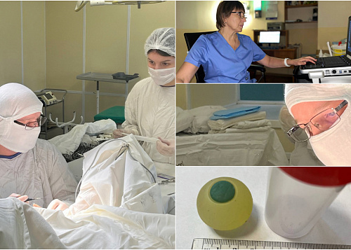 Челябинские хирурги нашли в кишечнике 9-летнего мальчика силиконовый глаз